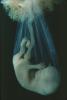 Human Embryo, Fetus, Embryo, HAIV01P03_16