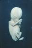 Human Embryo, Fetus, Embryo, HAIV01P04_01