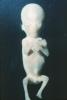 Human Embryo, Fetus, Embryo, HAIV01P04_02