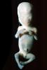 Human Embryo, Fetus, Embryo, HAIV01P04_05