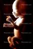 Human Embryo, Fetus, Embryo, HAIV01P04_07