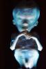 Human Embryo, Fetus, Embryo, HAIV01P04_10