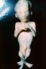 Human Embryo, Fetus, Embryo, HAIV01P04_13