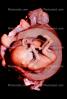 Human Embryo, Fetus, Embryo, HAIV01P04_15