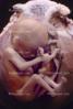 Human Embryo, Fetus, Embryo, HAIV01P04_18