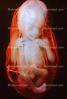 Human Embryo, Fetus, Embryo, HAIV01P05_01