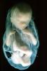 Human Embryo, Fetus, Embryo, HAIV01P05_02
