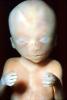 Human Embryo, Fetus, Embryo, HAIV01P05_06