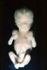 Human Embryo, Fetus, Embryo, HAIV01P05_07