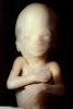 Human Embryo, HAIV01P05_10