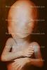 Human Embryo, HAIV01P05_11