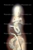 Human Embryo, HAIV01P05_13
