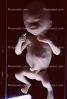 Fetus, Embryo, HAIV01P06_01