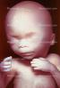 Fetus, Embryo