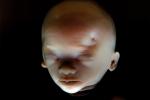 Fetus Face, Embryo, HAIV01P06_08B