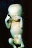 Fetus, Embryo, HAIV01P06_12