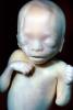 Fetus, Embryo, HAIV01P07_07