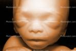 Fetus, Embryo, HAIV01P07_08