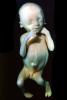 Fetus, Embryo, HAIV01P07_11