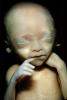 Fetus, Embryo, HAIV01P07_12