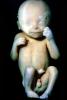 Fetus, Embryo, HAIV01P07_14