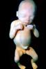 Fetus, Embryo, HAIV01P07_16