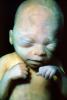 Fetus, Embryo, HAIV01P07_17