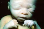 Fetus, Embryo, HAIV01P07_18