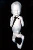 Fetus, Embryo, HAIV01P08_01