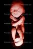 Fetus, Embryo, HAIV01P08_04