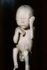 Fetus, Embryo, HAIV01P08_06