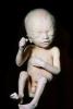 Fetus, Embryo, HAIV01P08_08