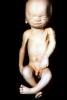 Fetus, Embryo, HAIV01P08_10