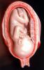 Fetus, Embryo, HAIV01P09_06