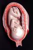 Fetus, Embryo, Embryology, Fetal Development, HAIV01P09_07