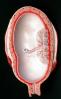 Uterus, Womb, Fetus, Embryo, HAIV01P09_14