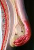 fallopian tube, ovary, HAIV01P09_19