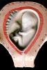 Fetus, Womb, HAIV01P10_05