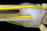 wrist bone structure, HAMV01P02_03