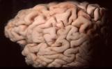Real Human Brain, HANV01P03_16