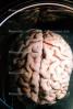 Real Human Brain, HANV01P04_04