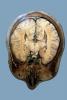 Brain, Head, HANV01P05_04