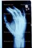 X-Ray, Hand
