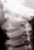 neck, vertebrae, X-Ray, HASV01P06_16