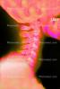 neck, vertebrae, X-Ray, HASV01P07_01B.2014