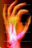 hand, fingers, knuckles, X-Ray, HASV01P08_04B