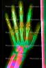 hand, fingers, knuckles, X-Ray, HASV01P08_05C.2014