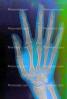 hand, fingers, knuckles, X-Ray, HASV01P08_06B