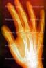hand, fingers, knuckles, X-Ray, HASV01P08_12B