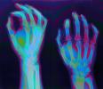 hand, fingers, knuckles, X-Ray, HASV01P08_15C.2014